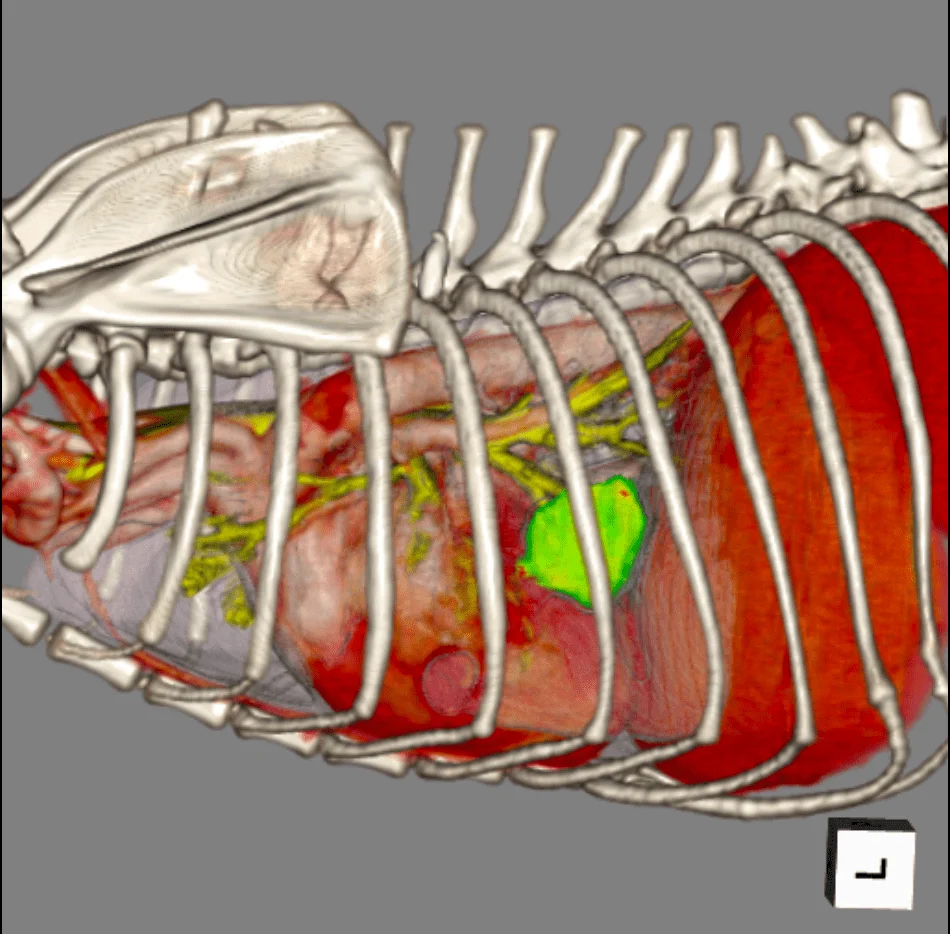 ct3d画像