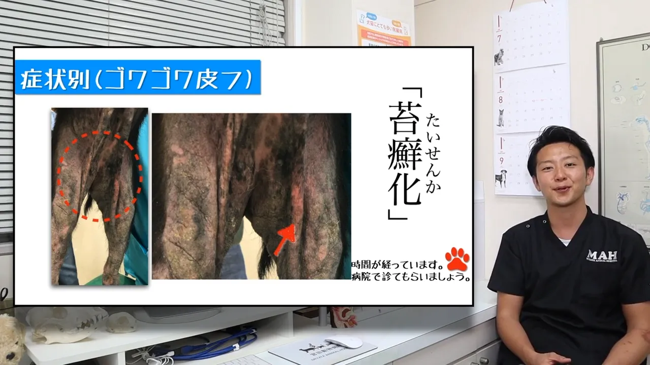皮膚がゴワゴワ・厚くなっている（苔癬化）