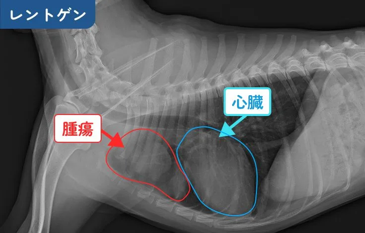 レントゲン画像