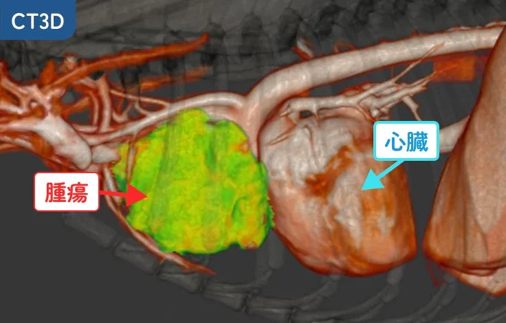CT3D画像