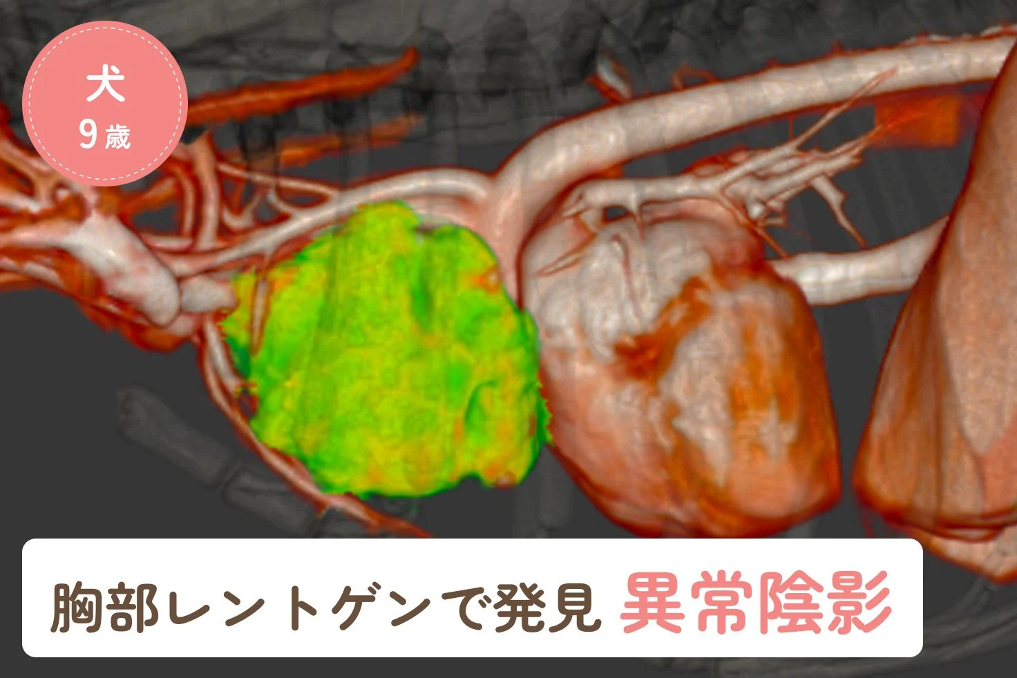 胸部レントゲン検査で見つかった異常陰影のアイキャッチ画像