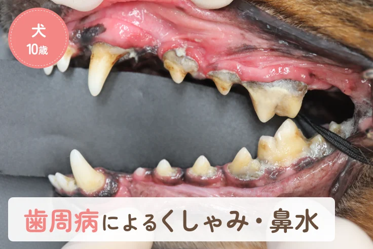 歯周病が原因となったくしゃみ・鼻水｜口腔鼻腔瘻の診断・治療を行った症例のアイキャッチ画像