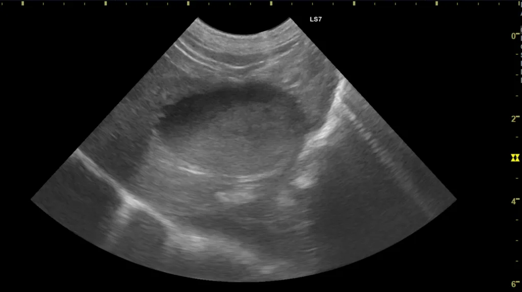 犬の胆嚢内で胆汁と胆泥が分かれてみられる超音波画像